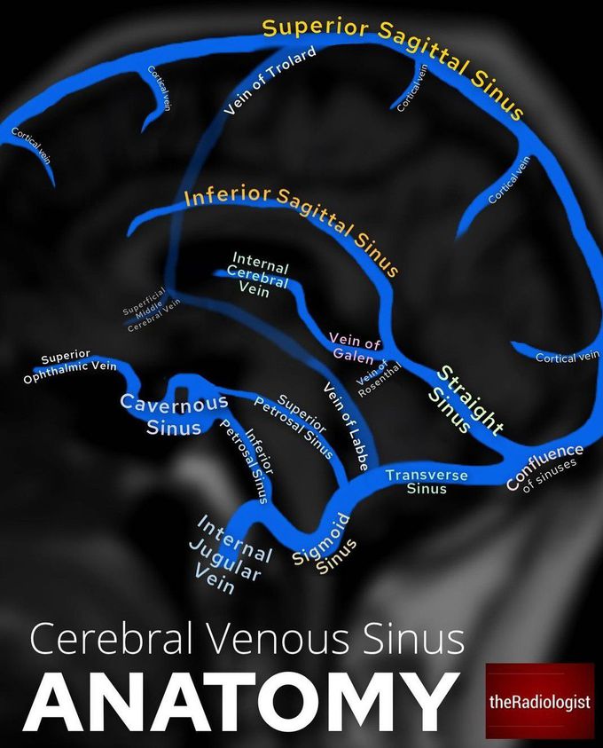 Cerebral Venous Sinus Anatomy