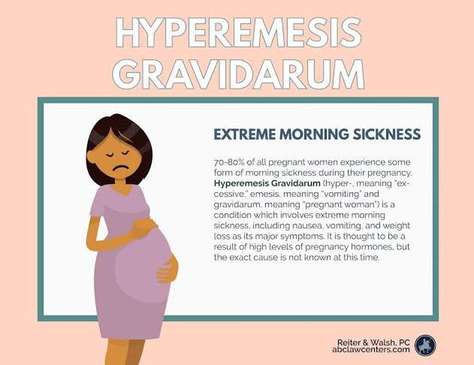 Causes of hyperemesis gravidarum