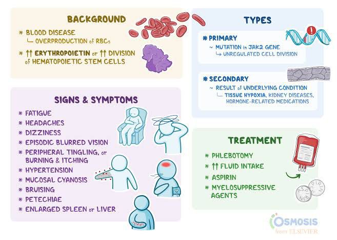 Polycythemia vera - MEDizzy