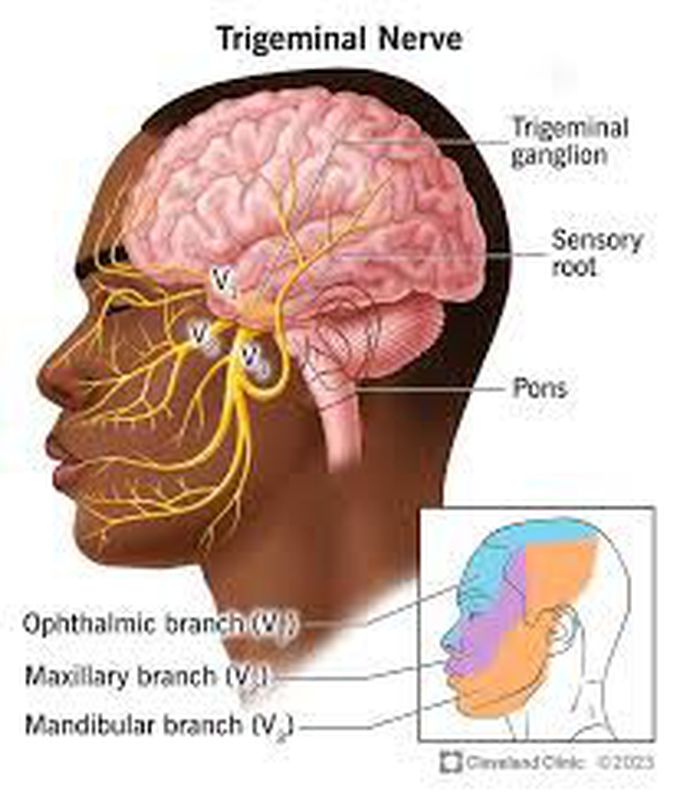 Cause of trigeminal neuralgia