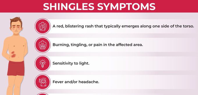 Symptoms of Shingles