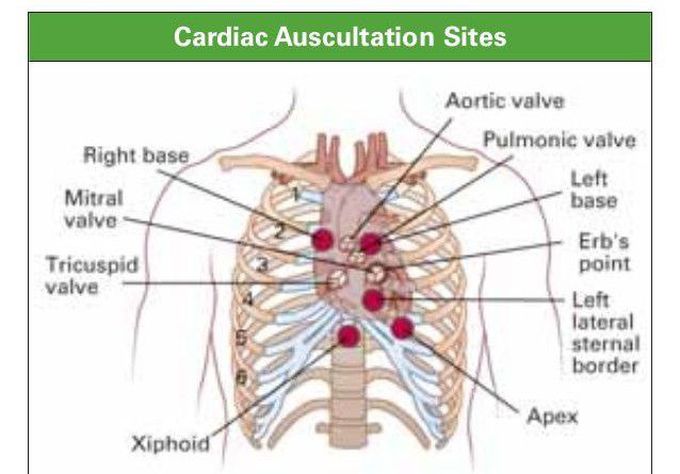 Cardiac Auscultation Sites