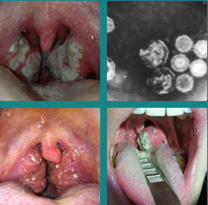 Diagnosis !?