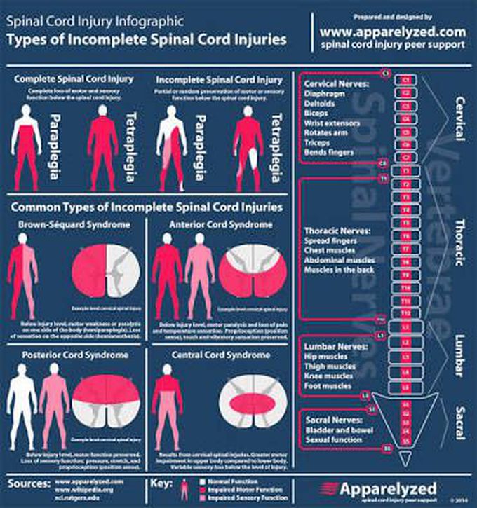 Spinal cord injury