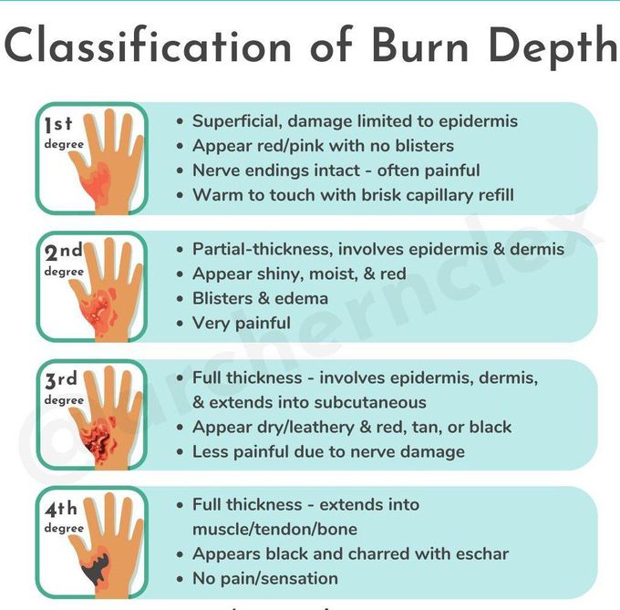 Burn Depth Classification