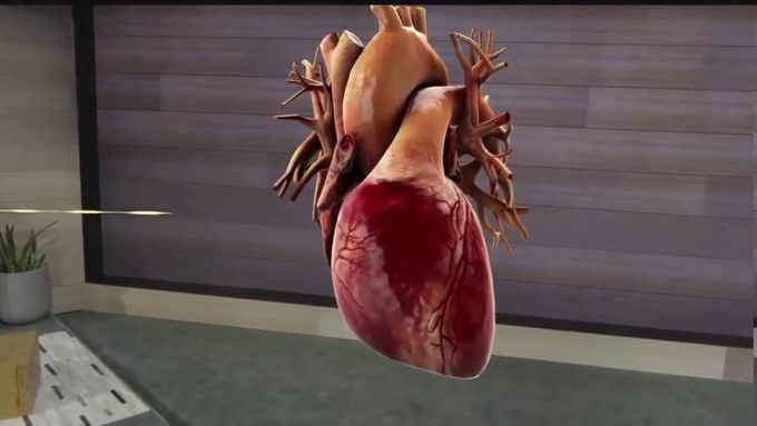 Microsoft HoloLens. Medical Education