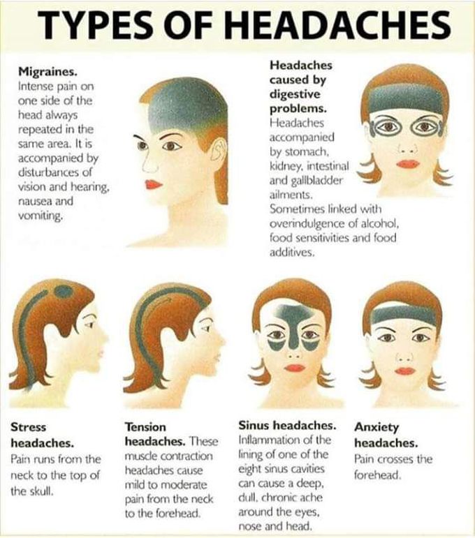 Headaches.