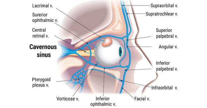 Cavernous sinus thrombosis