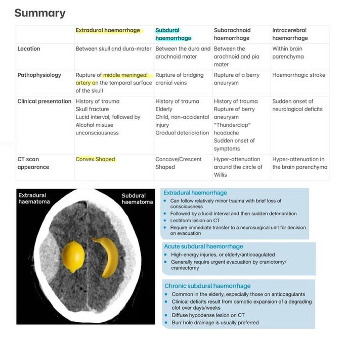 Extradural Hematoma Vs Subdural Hematoma