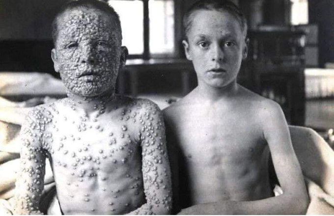 VACCINATION!