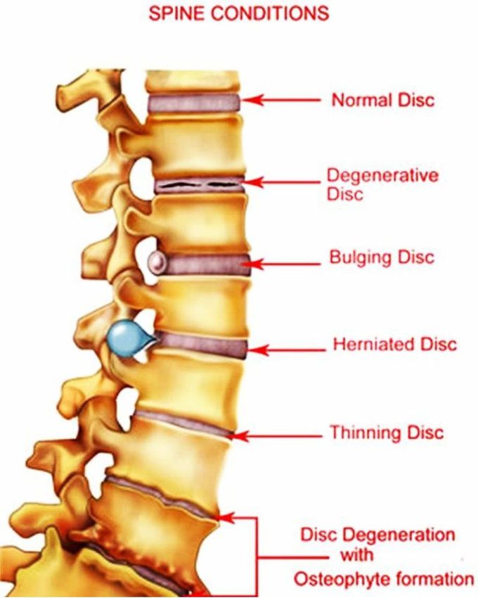 Spine