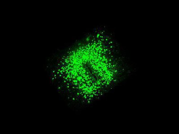 Same nerve cell -- Different influence on food intake