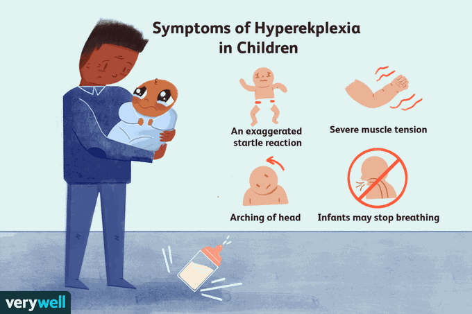 Symptoms of Hyperekplexia