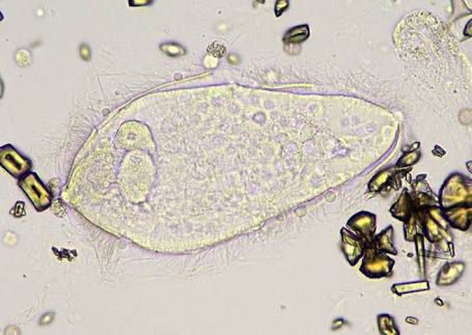 Schistosoma