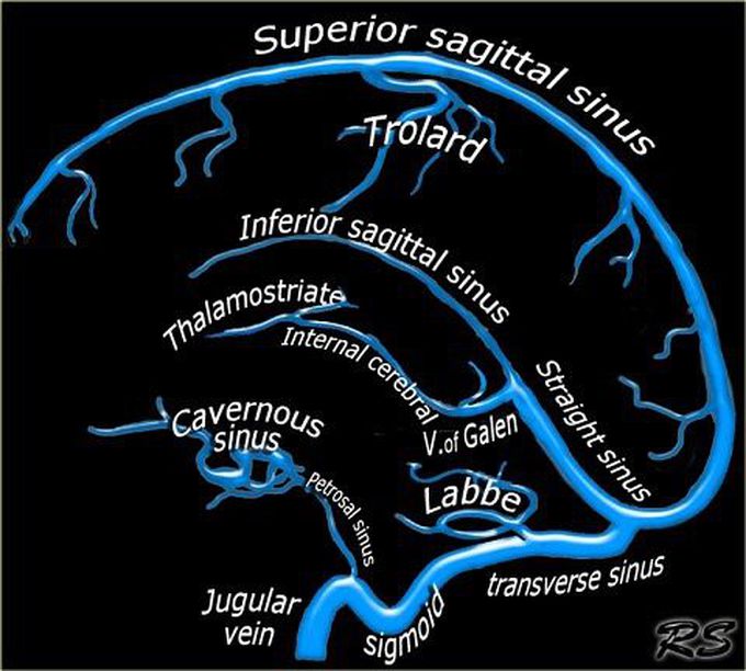 Cerebral venous sinuses