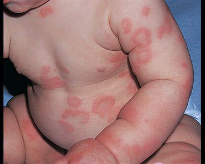 DIAGNOSIS ...???? ANYONE CORRECT ANSWER