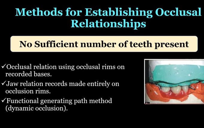 Occlusal Relationship - No Sufficient Teeth