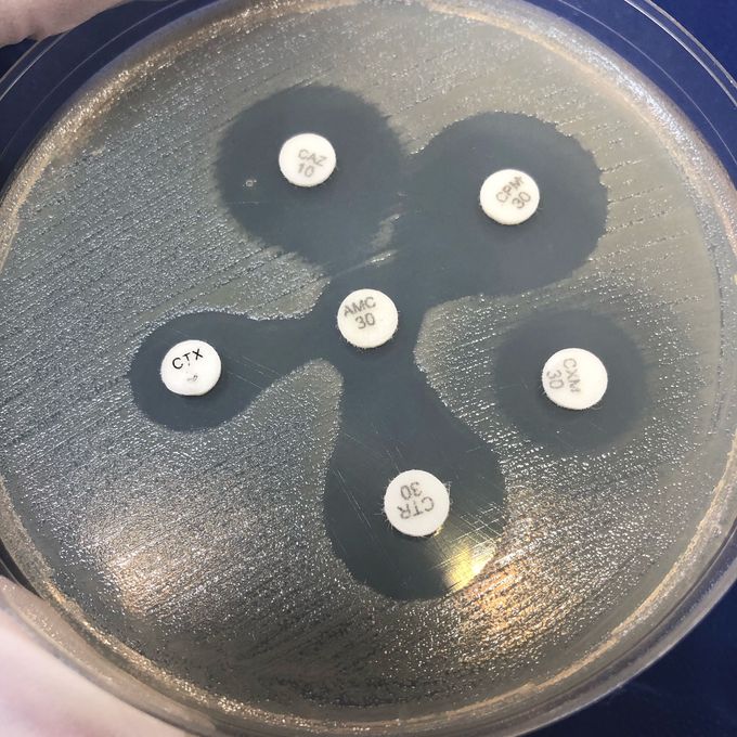 Escherichia coli has grown 70,000 CFU/ml in urine cultivation of a 2 month old boy. You will see a picture of the antibiotic sensitivity test. Stammer is GSBL positive.