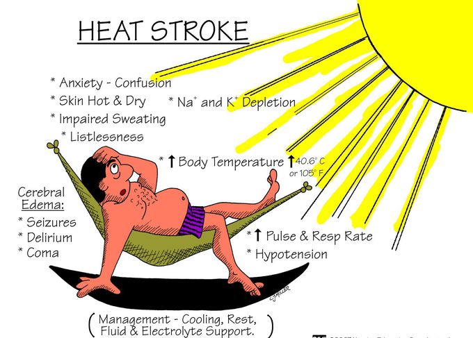 Heat stroke