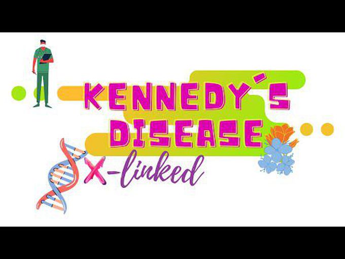 Spinal and Bulbar Muscular Atrophy (Kennedy Disease)