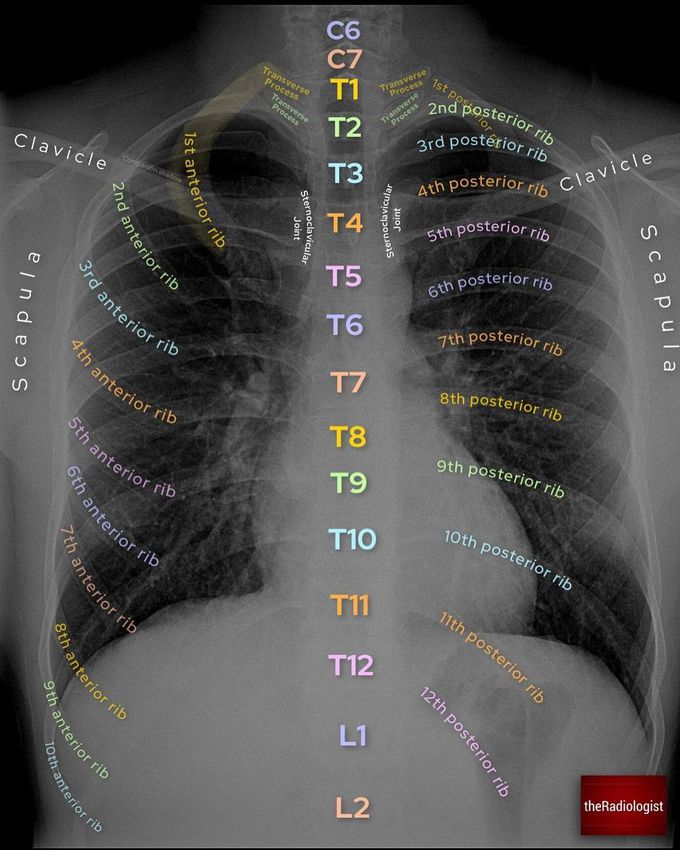 3D CT Thorax II