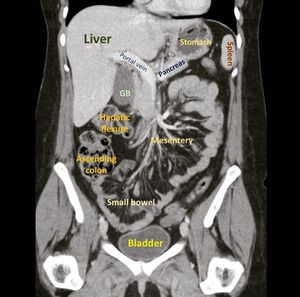 X ray abdomen erect - MEDizzy