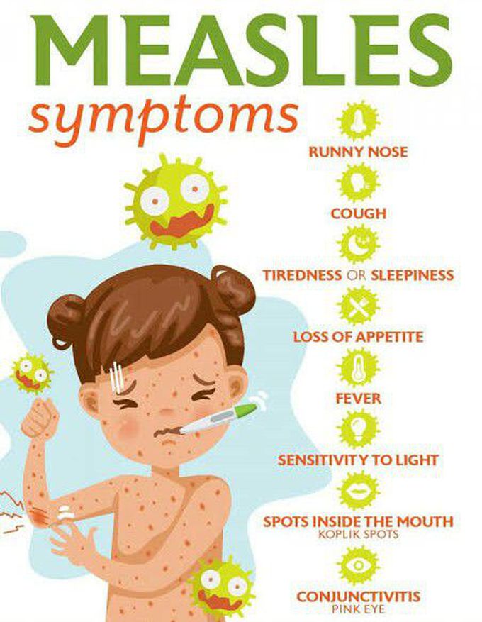 Measles
