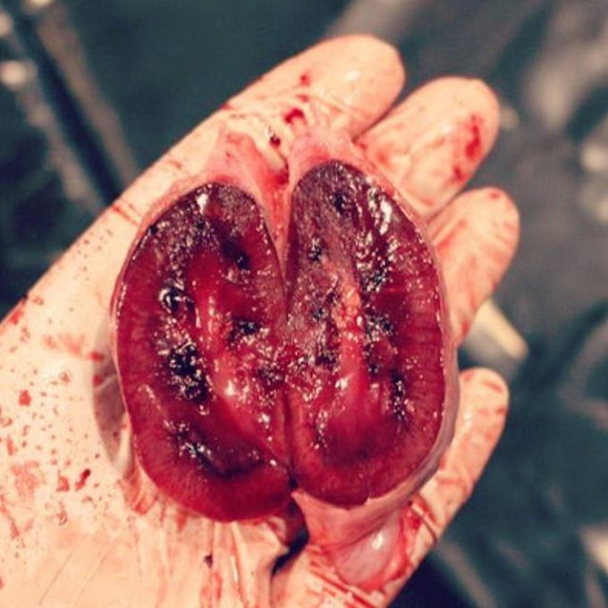 This is the cutest kidneys shot i have ever seen