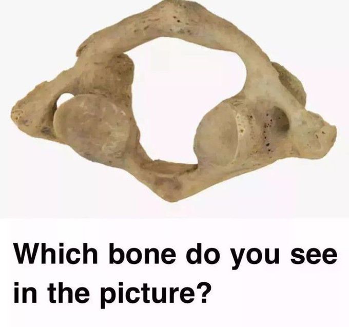 Identify the Bone