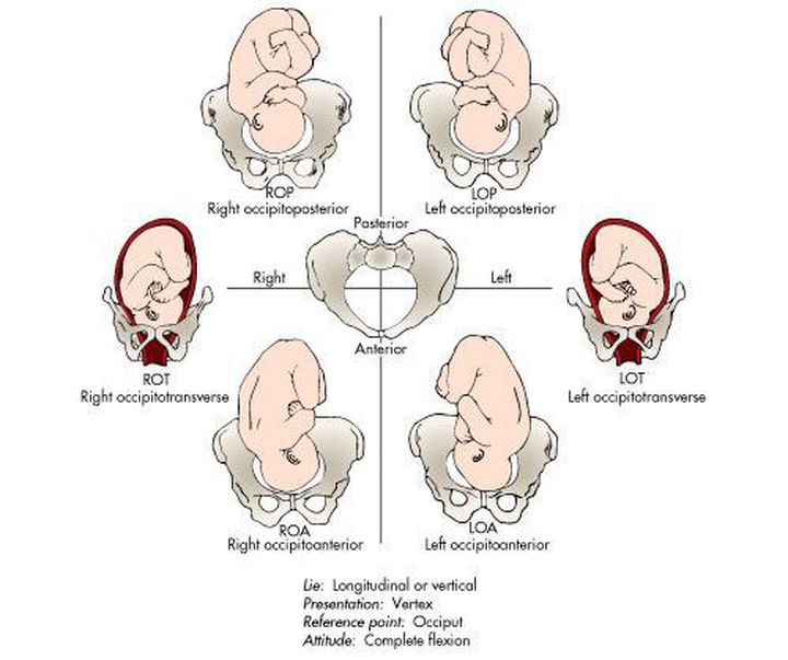 name of abnormal presentation