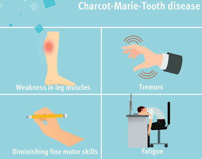 These are the symptoms of Charcot Marie tooth syndrome