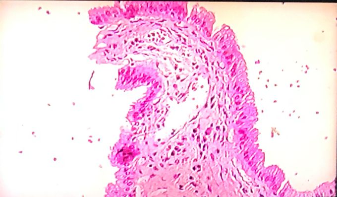 Bladder epithelial tissue