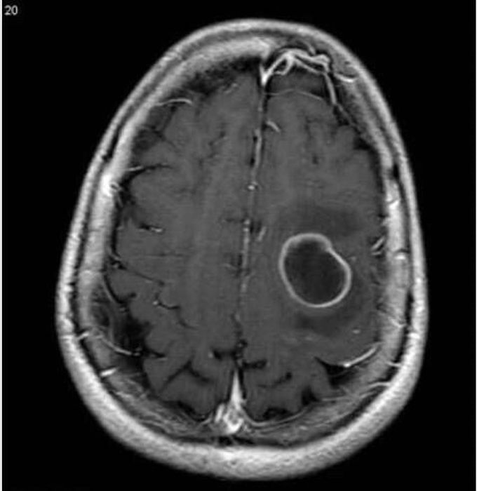 Diagnosis