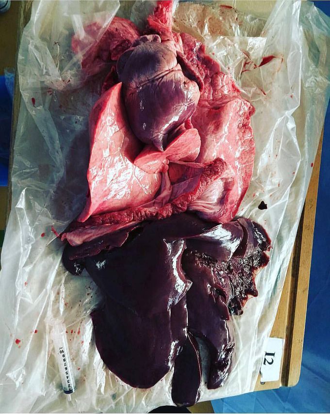 Autopsy is very amazing!! 