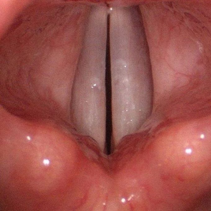 The vocal cords