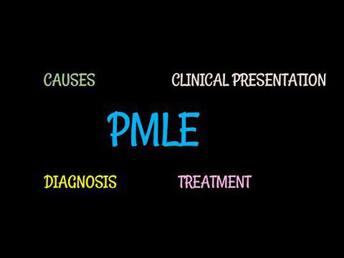 Progressive Multifocal Leukoencephalopathy (PML)