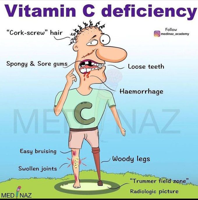 Vit C deficiency symptoms