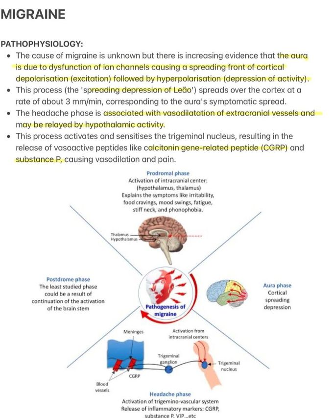 Migraine I