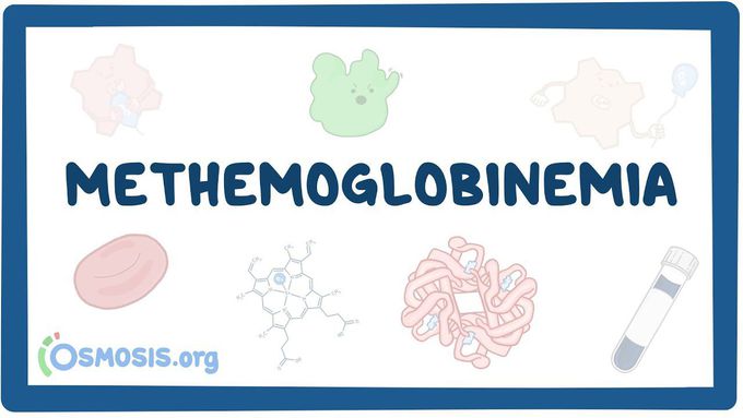 Methemoglobinemia