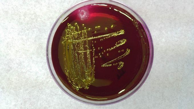 Escherichia coli