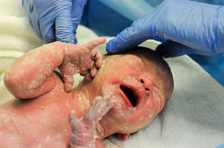 Vernix Caseosa: Wash It Off Baby After Birth or Rub It In?