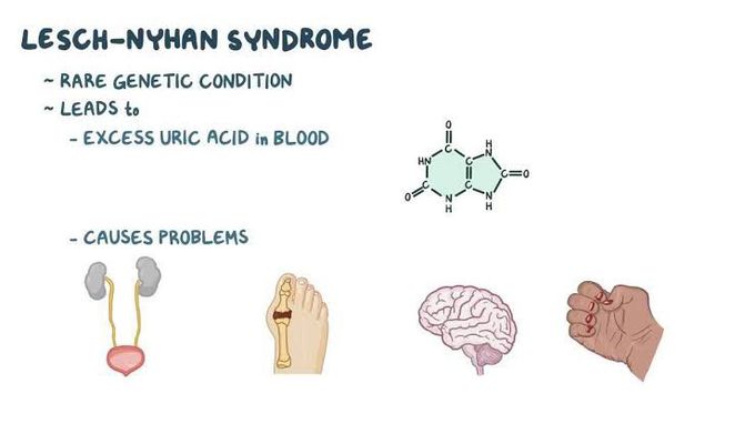 Lesch-nyhan syndrome
