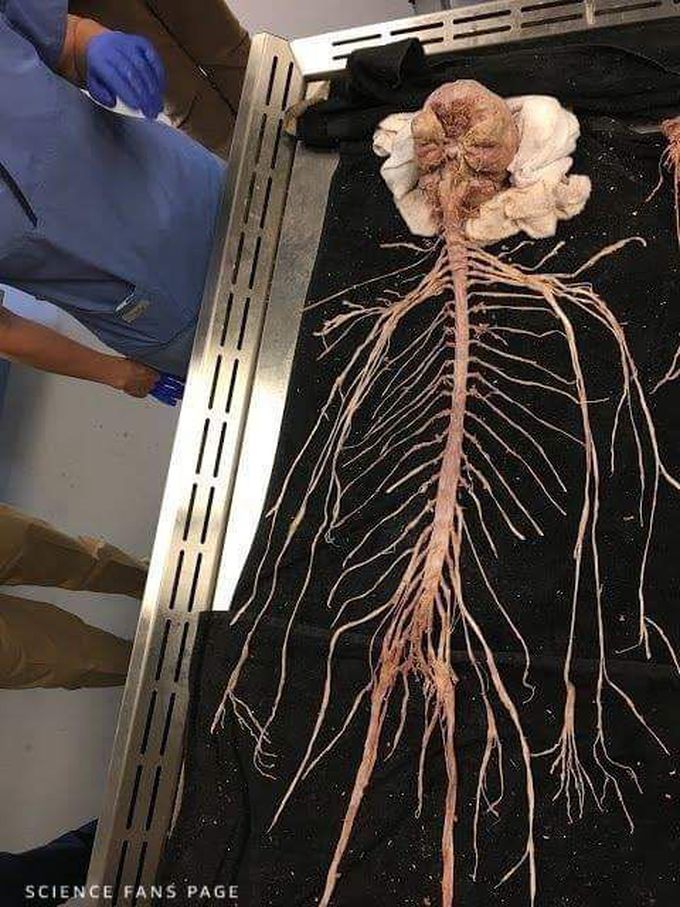 Human Nervous System