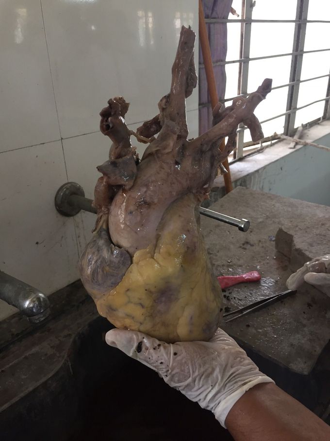 Heart