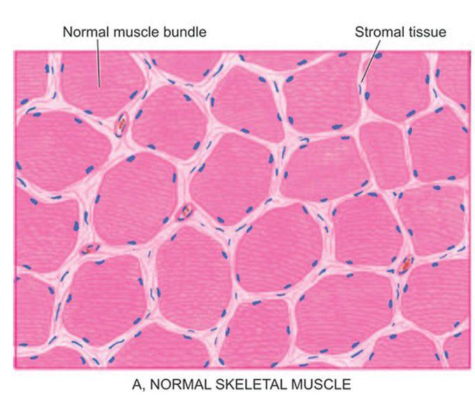 Skeletal muscle