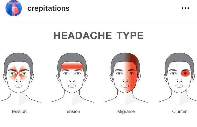 Headache Types