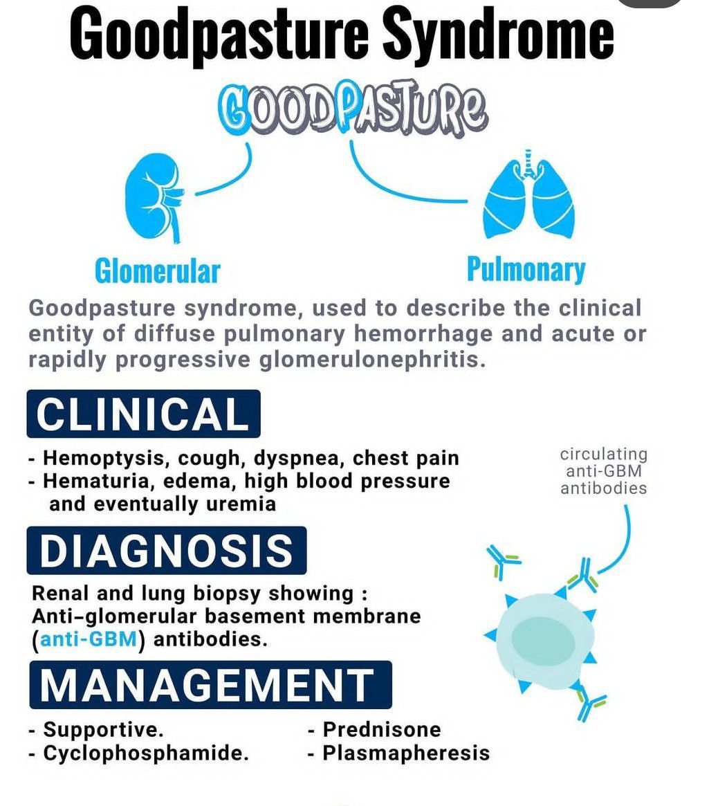 Goodpasture Syndrome Medizzy