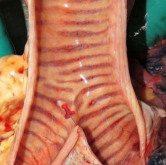 A great view of the trachea. 