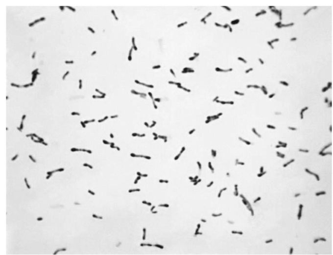 Microbiology 
A 3-year-old boy is brought to the hospital with a sore throat, fever, malaise, and difficulty breathing. Physical examination reveals the presence of a gray membrane covering the pharynx. Questioning of the mother reveals that the boy had not received any vaccinations. Dx?