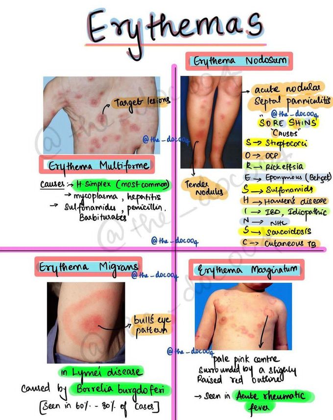 Erythema